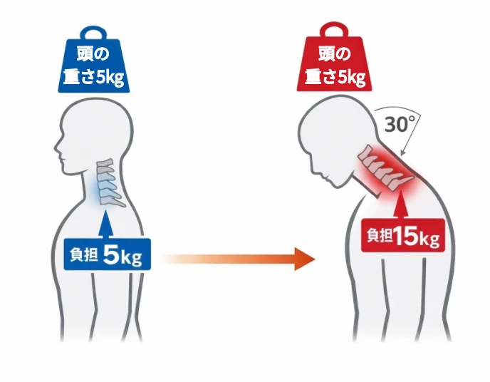 首の角度で肩に負担が増える